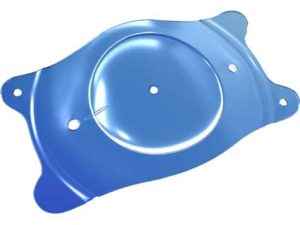 operation-forte-myopie-implant-ICL