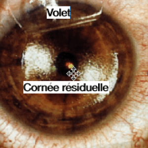 chirurgie-refractive-lasik-epaisseur-cornee-residuelle