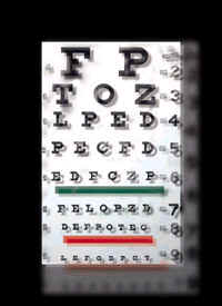 laser-vision-double-floue-operation-myopie