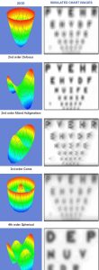 astigmatisme-laser-aberrations-optiques