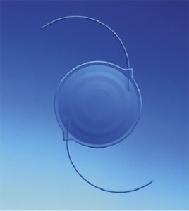 operation-cataracte-sans-lunettes-lecture-implant-multifocal